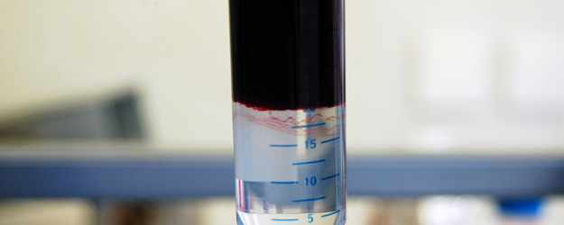 Blutprobe unterschichtet (Foto: FZI)