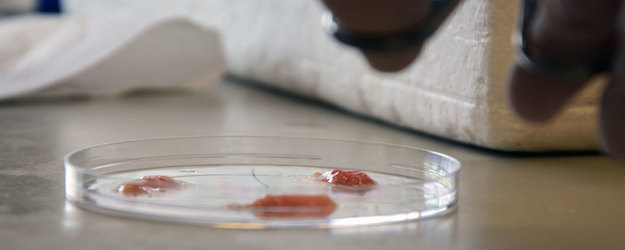 Vorbereitung von Gewebeproben